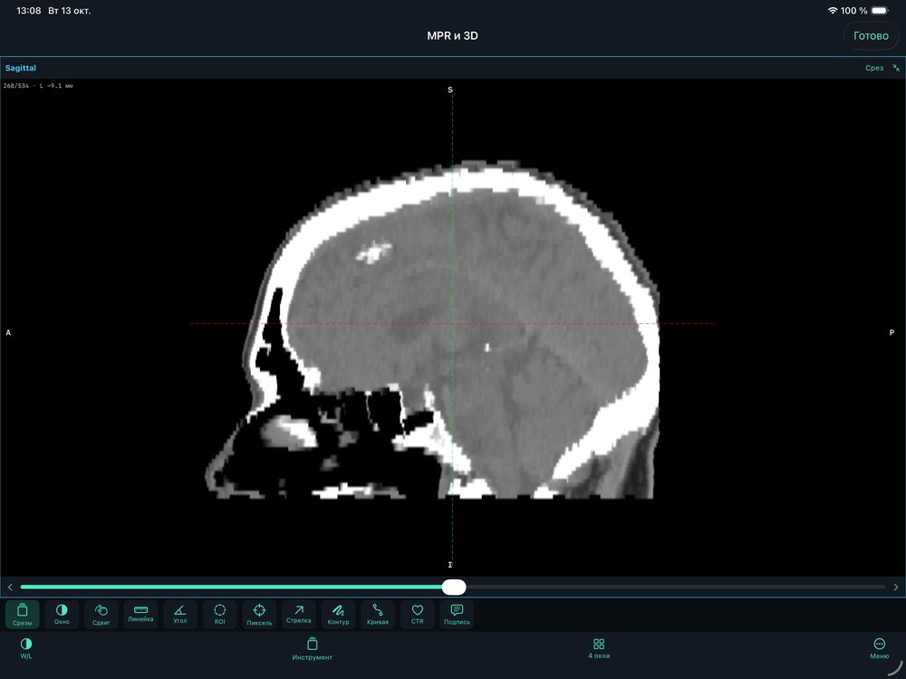 Sagittal plane on its own