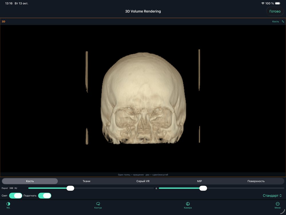 Volume Rendering: Bone