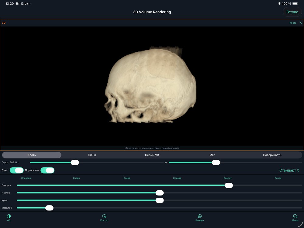 3D: camera and viewpoints