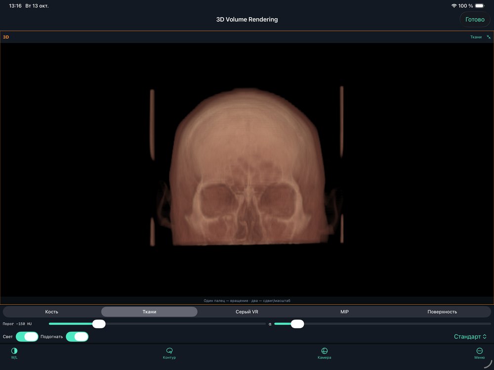 Volume Rendering: Tissues