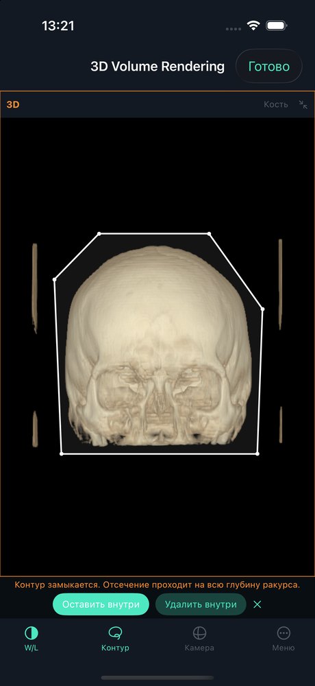 3D: a custom cutting contour