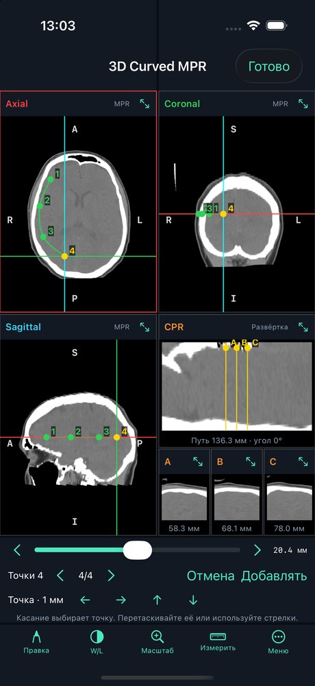 Curved MPR and A/B/C sections