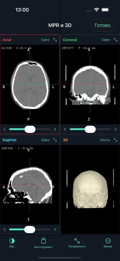 Four linked views on iPhone