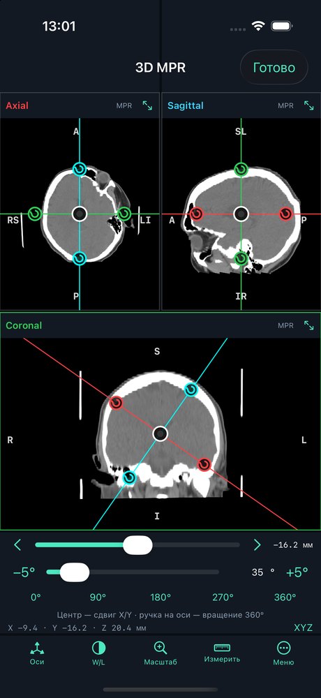 3D MPR: rotation on iPhone