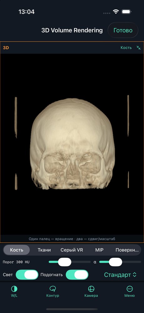 Volume Rendering on iPhone